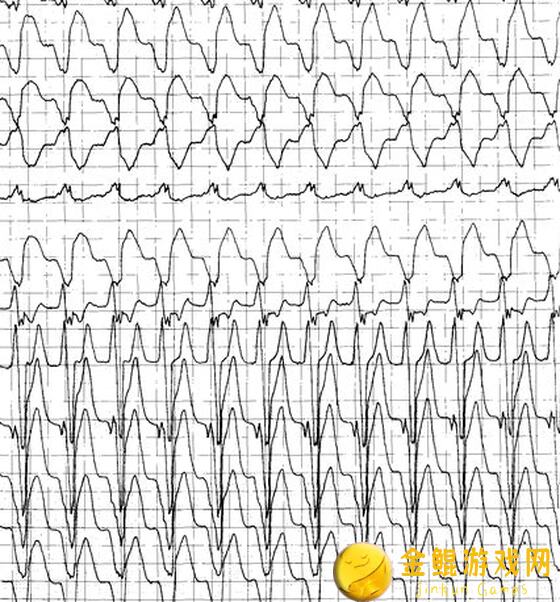 心动小镇公测必看！一键拎包住进梦中情家攻略全解析
